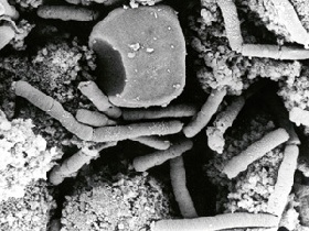 Бактерии сибирской язвы. Фото с сайта: www.wikipedia.org