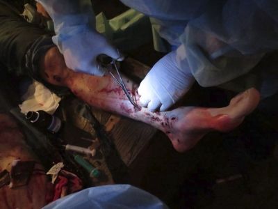 Раненый на Евромайдане. Фото: Аркадий Бабченко
